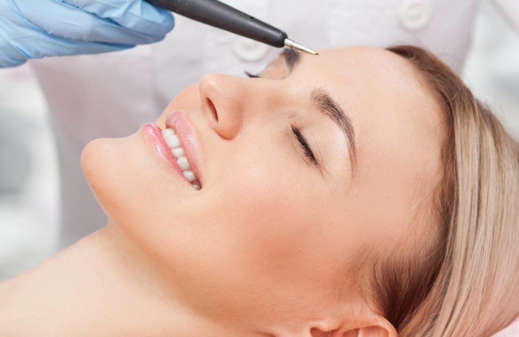 electrolysis-shepparton-skin-aesthetics